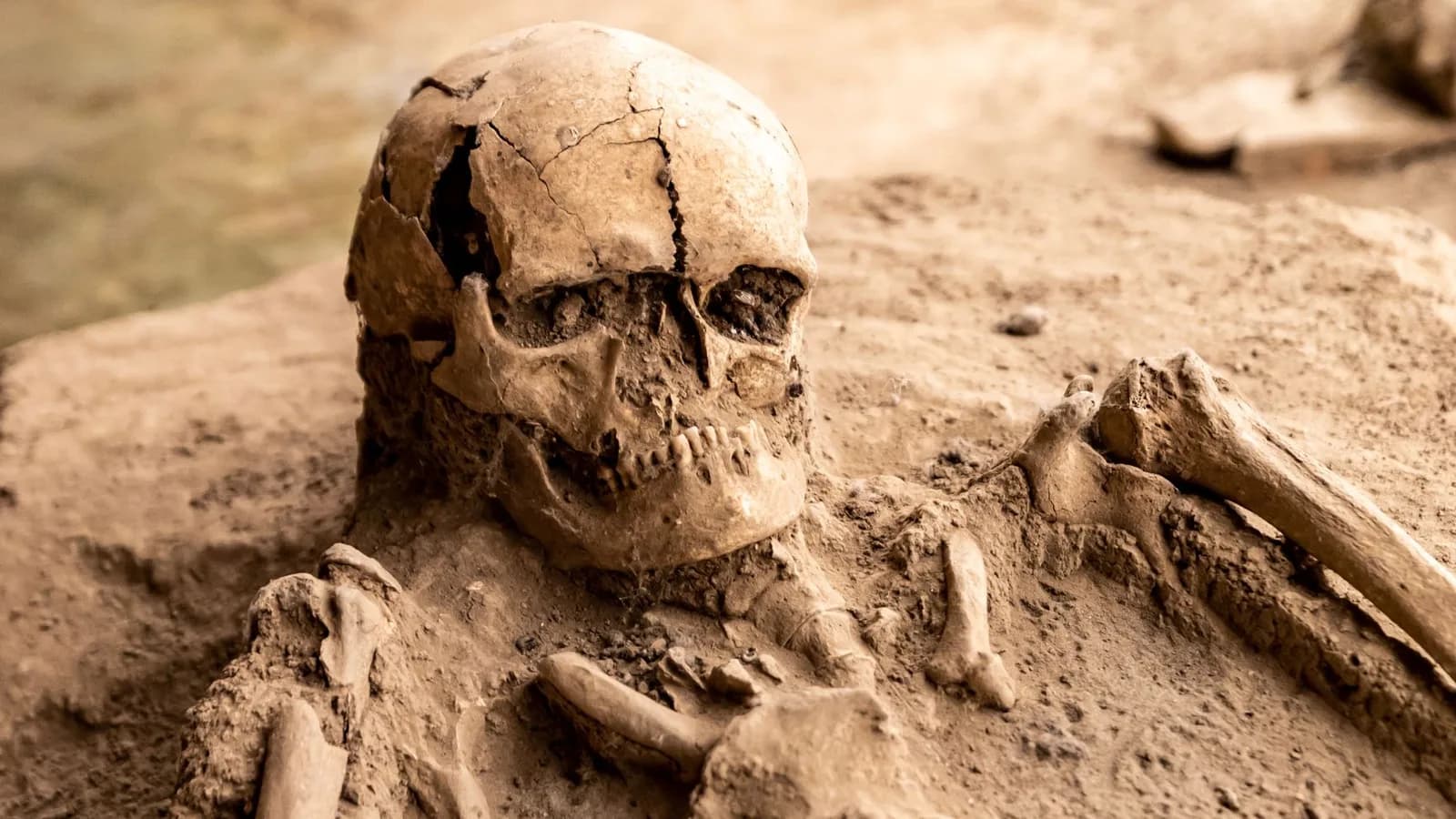 A human skull and ribs partly uncovered in the soil of an excavation