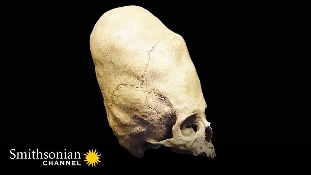 Evidence of an Ancient Horrifying Practice 💀 Riddle Of The Roman Skulls | Smithsonian Channel
