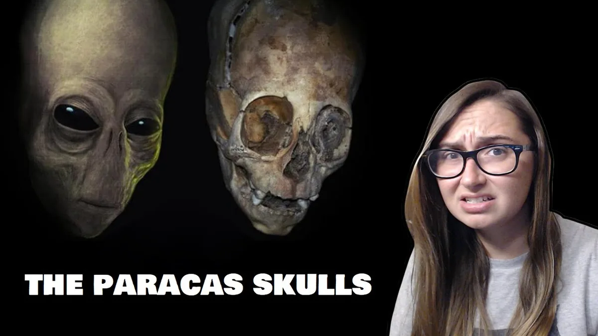 Are the Paracas Skulls ALIEN? | The Mindblowing Nonsense of Gaia Streaming
